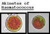 haemotococAkinete.jpg (10982 bytes)